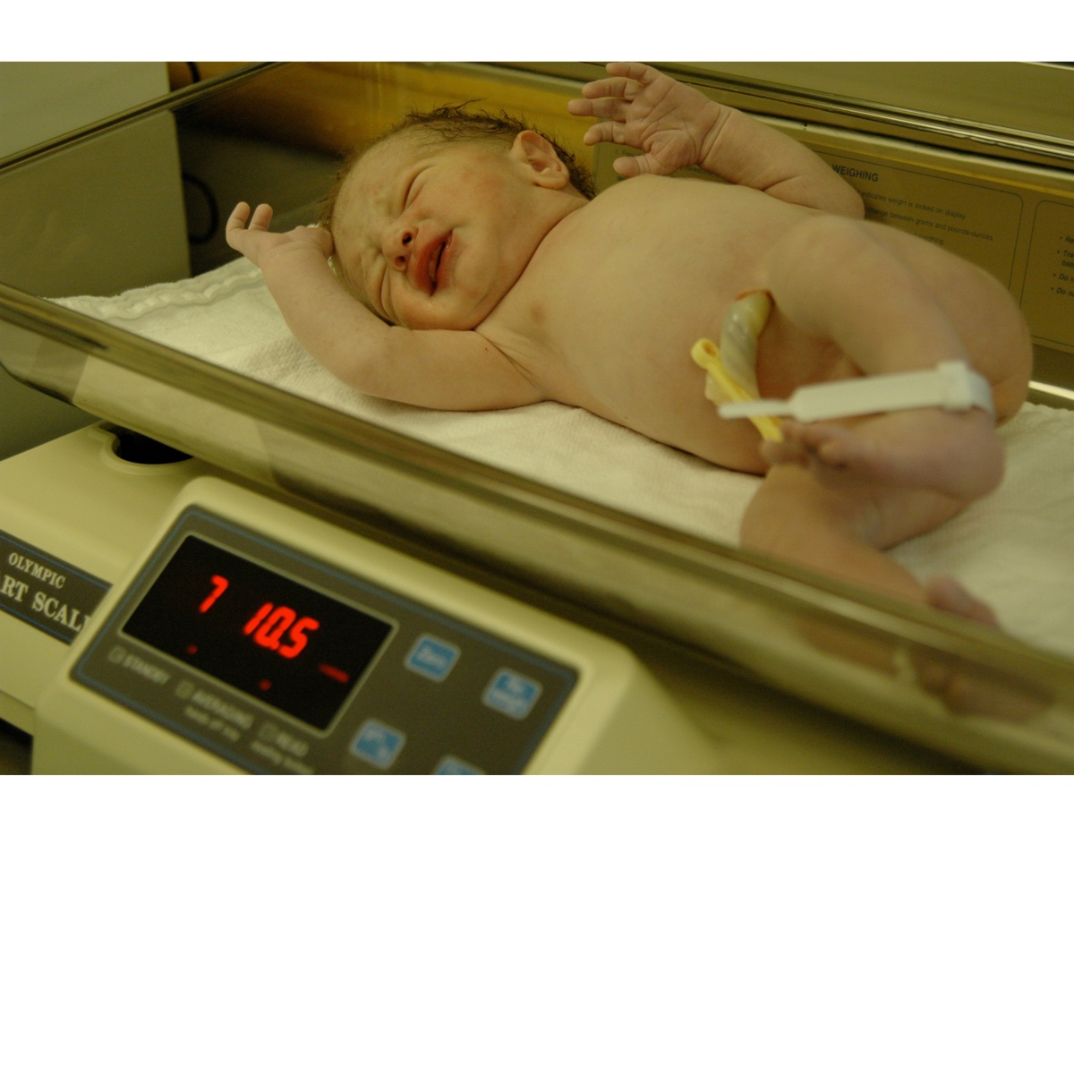 Mastering Intake Calculations for Breastfeeding Success: A Guide for Healthcare Professionals