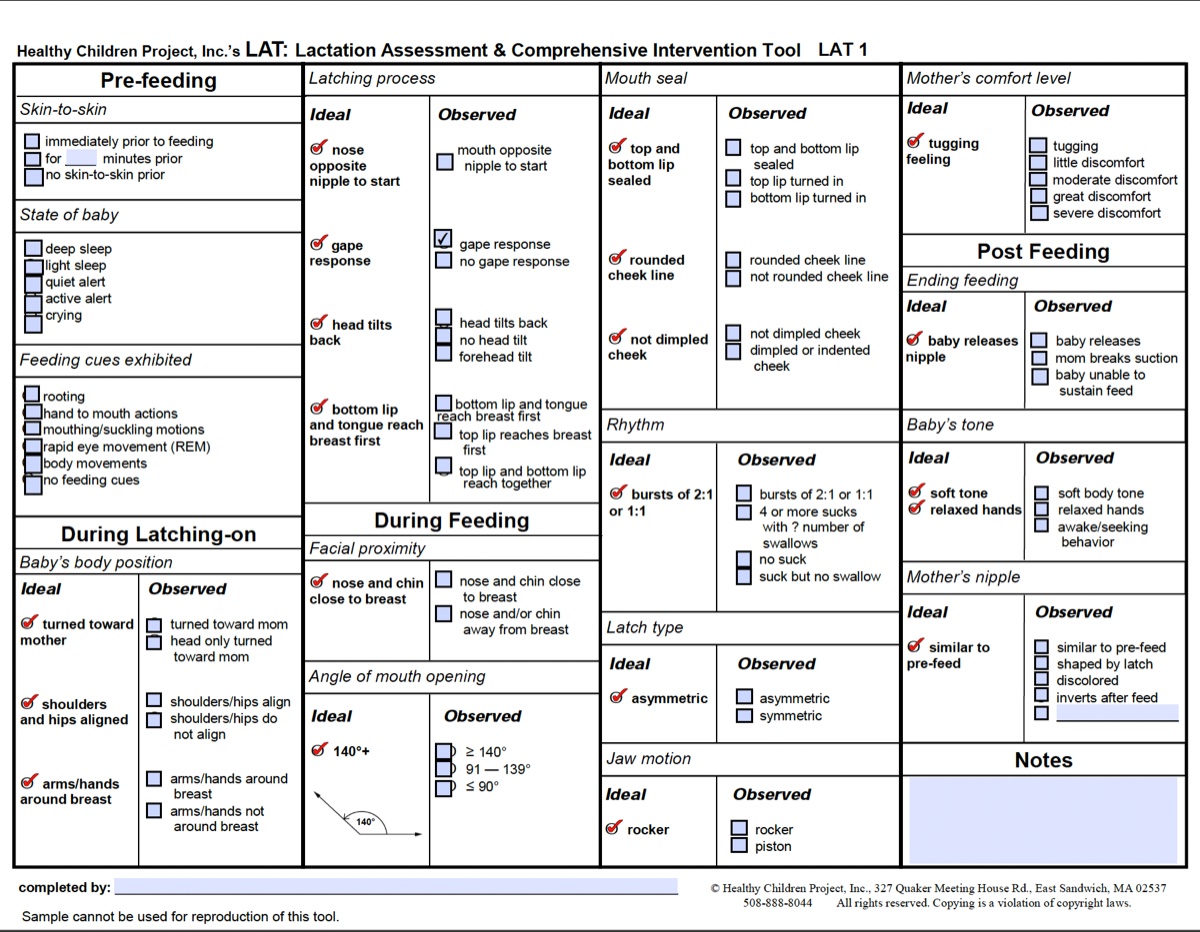 Exploring Breastfeeding Assessment Tools: Guiding Practice with Evidence-Based Methods