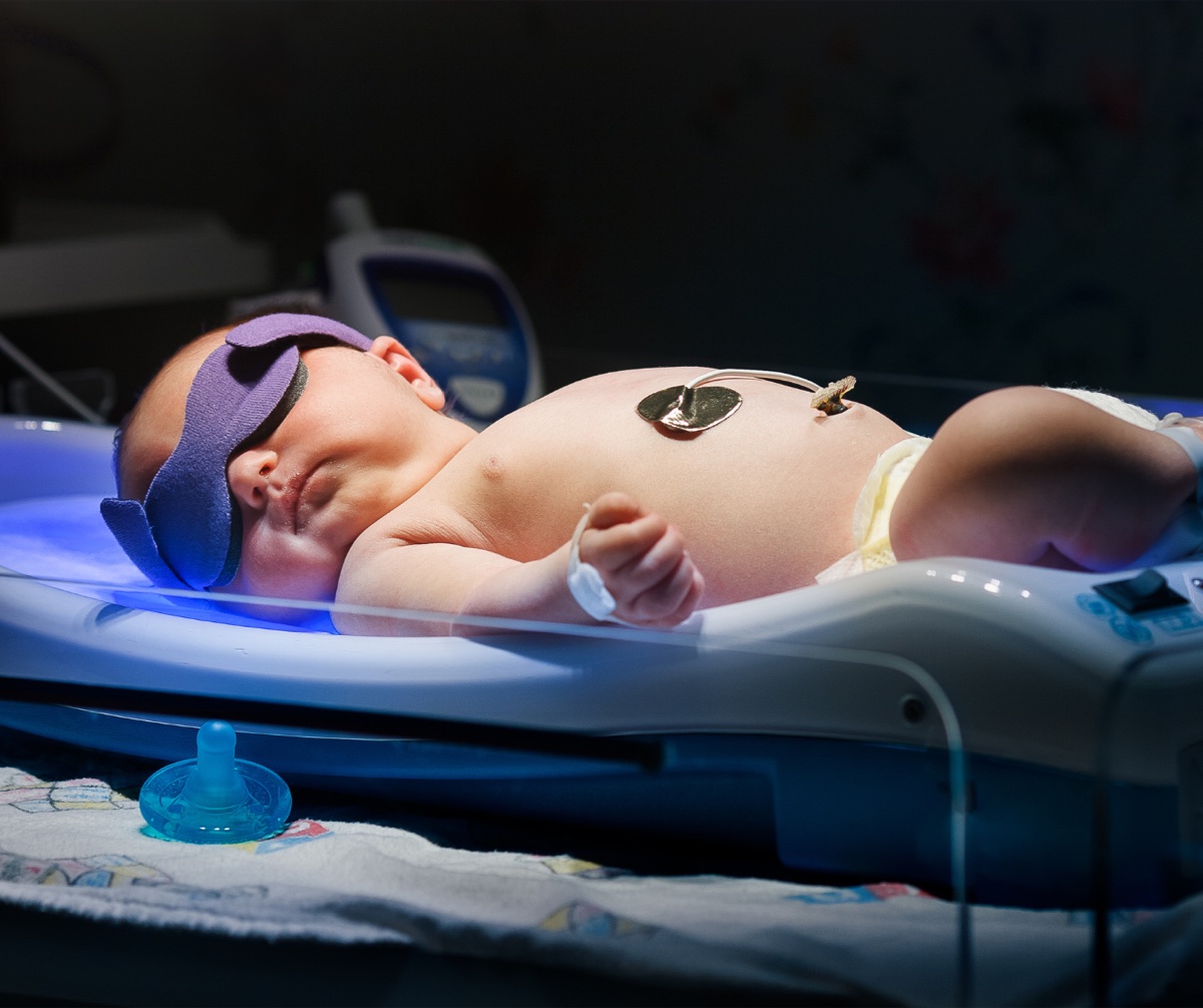 Managing Hyperbilirubinemia in Breastfeeding Infants: Protecting Breastfeeding While Treating Jaundice