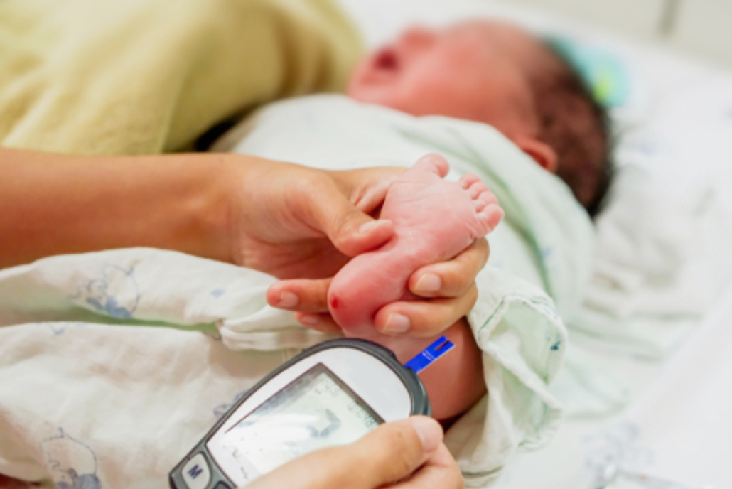 Managing Hypoglycemia in a Breastfed Newborn: Protecting Breastfeeding While Ensuring Safety