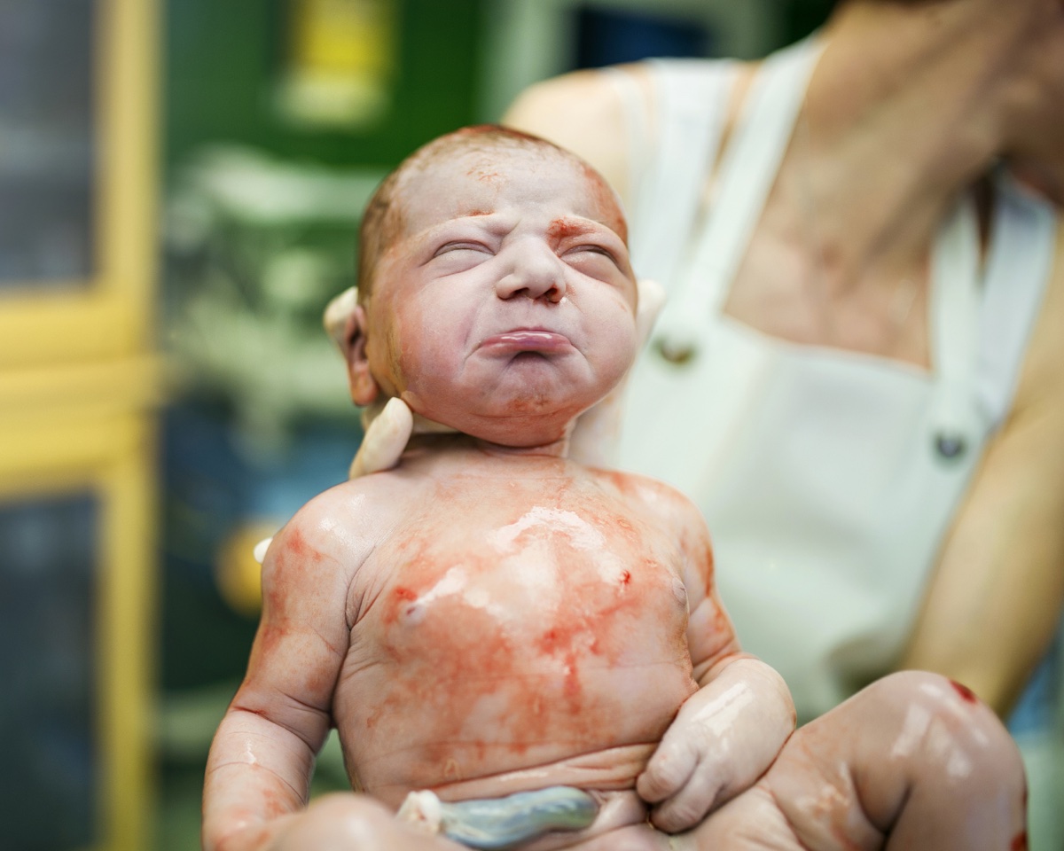 The Apgar Score: History, Application, and Relevance for Lactation Professionals