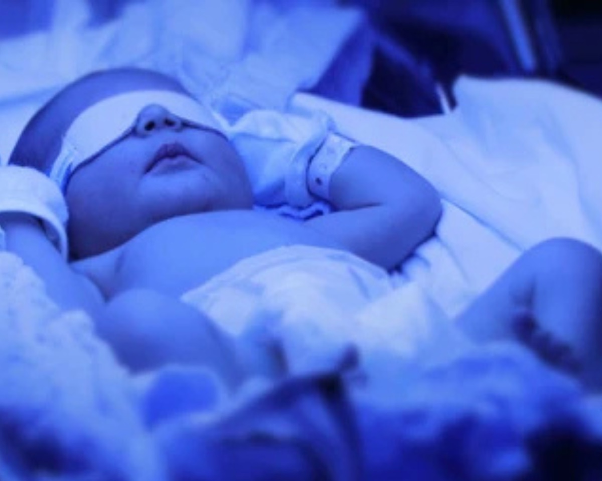 Understanding Jaundice in Breastfed Infants: What Lactation Consultants Need to Know